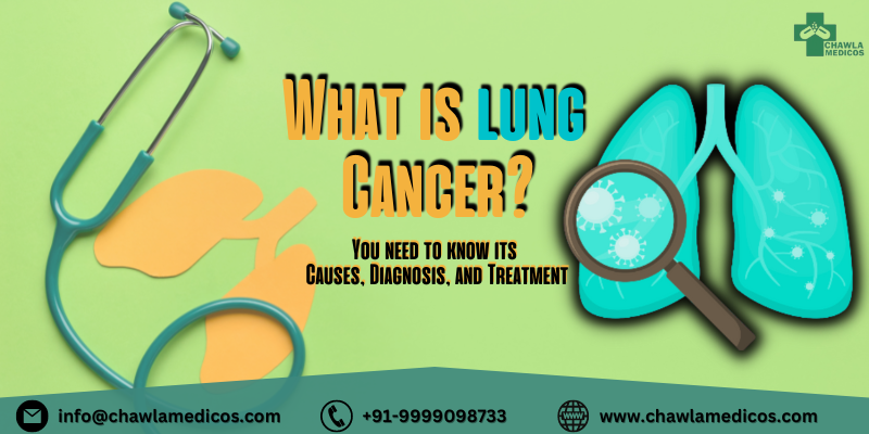 Lung Cancer - You need to know