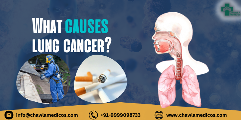 What causes lung cancer